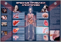 Электрифицированный стенд "Вредные привычки: алкоголизм" - «globural.ru» - Туймазы